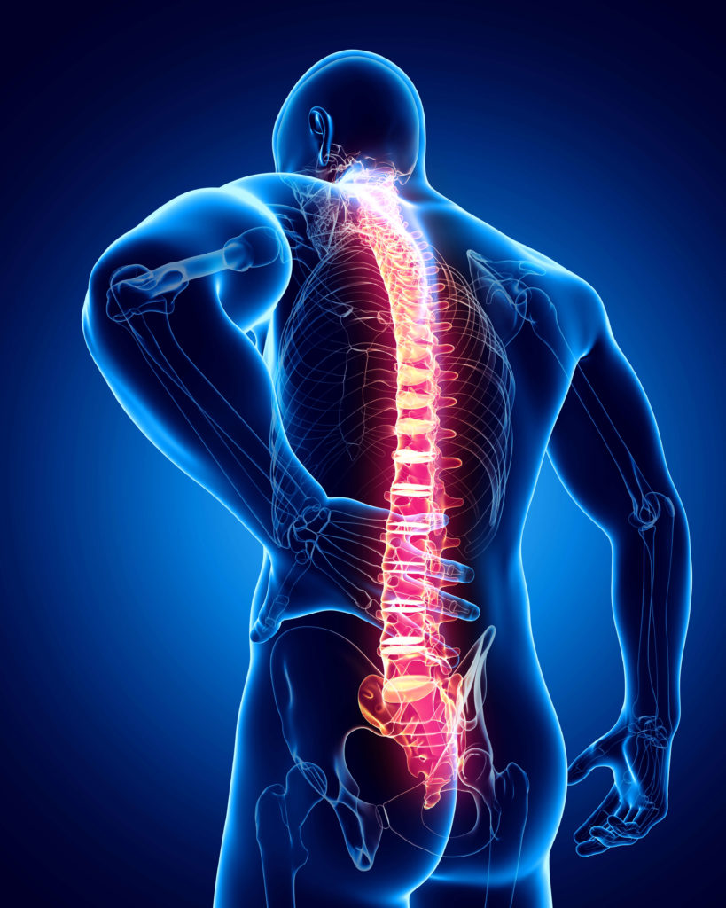 Spinal Cord Injury